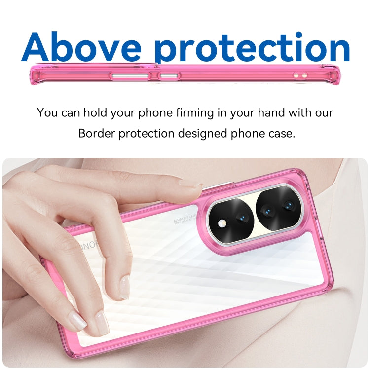 For Honor 70 Pro 5G Colorful Series Acrylic + TPU Phone Case