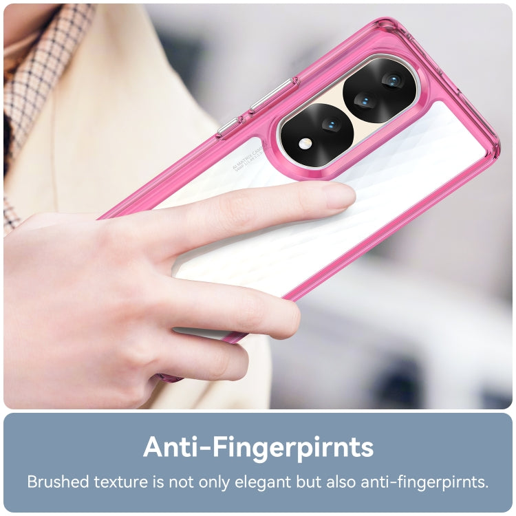 For Honor 70 Pro 5G Colorful Series Acrylic + TPU Phone Case