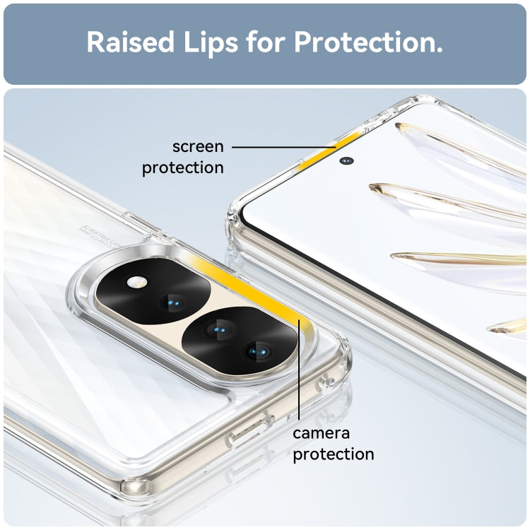 For Honor 70 Pro 5G Colorful Series Acrylic + TPU Phone Case