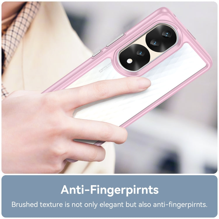 For Honor 70 Pro+ 5G Colorful Series Acrylic + TPU Phone Case