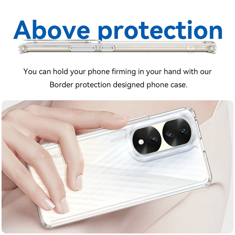 For Honor 70 Pro+ 5G Colorful Series Acrylic + TPU Phone Case