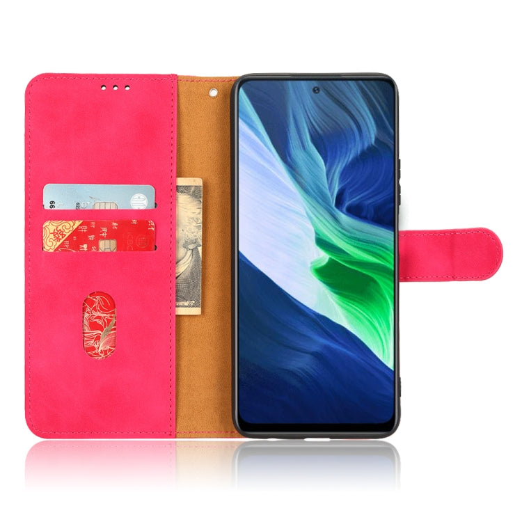 For Infinix Note 10 Skin Feel Magnetic Flip Leather Phone Case