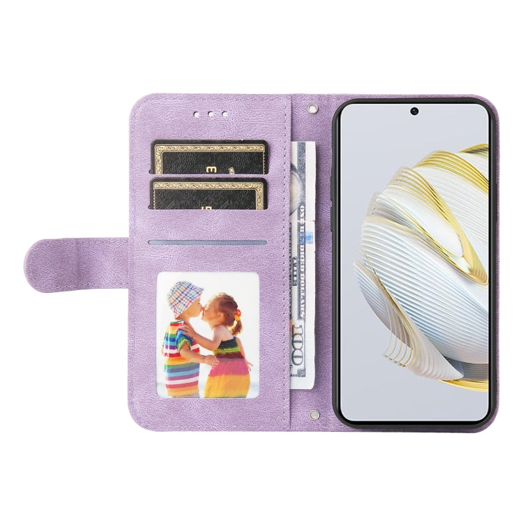 For Huawei nova 10 SE Skin Feel Life Tree Metal Button Leather Phone Case