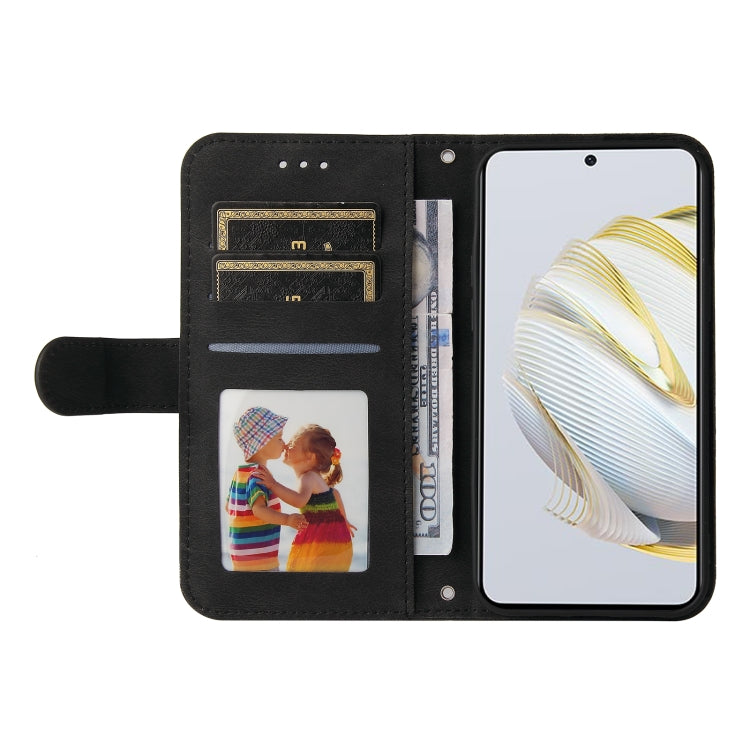 For Huawei nova 10 SE Skin Feel Life Tree Metal Button Leather Phone Case