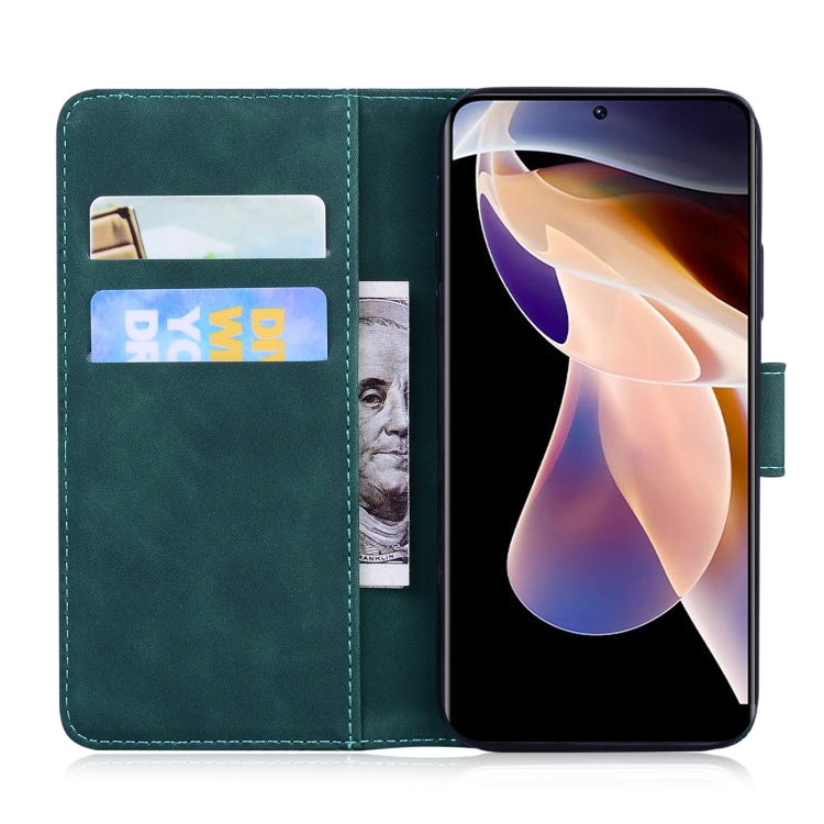 For Xiaomi Redmi 11 Prime 4G Skin Feel Pure Color Flip Leather Phone Case