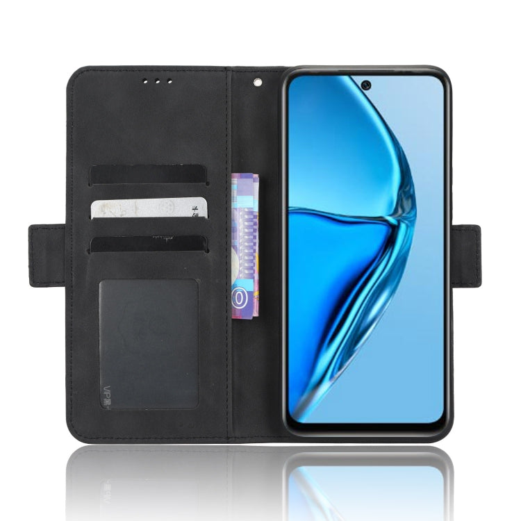 For Infinix Hot 20 4G X682B Skin Feel Calf Texture Card Slots Leather Phone Case