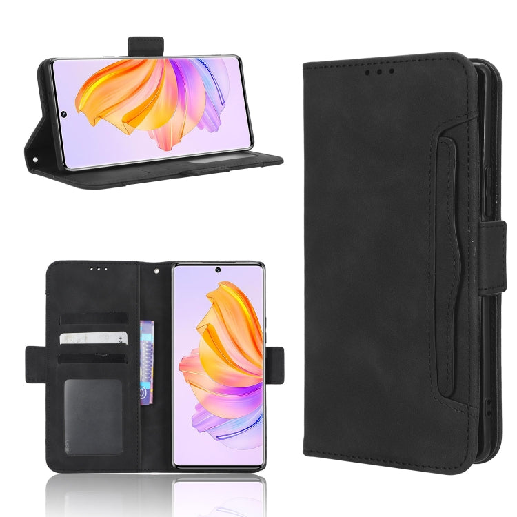 For Honor 80 SE 5G Skin Feel Calf Texture Card Slots Leather Phone Case