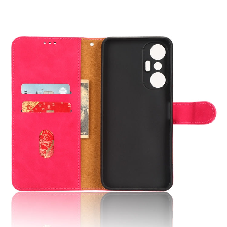 For Infinix Hot 20S Skin Feel Magnetic Flip Leather Phone Case