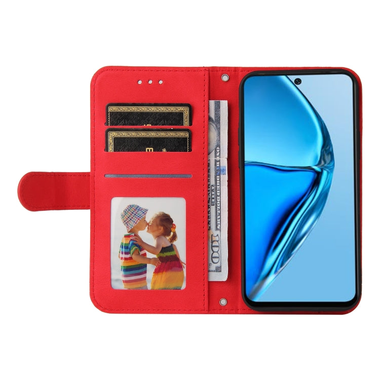 For Infinix Hot 20 4G Skin Feel Life Tree Metal Button Leather Phone Case