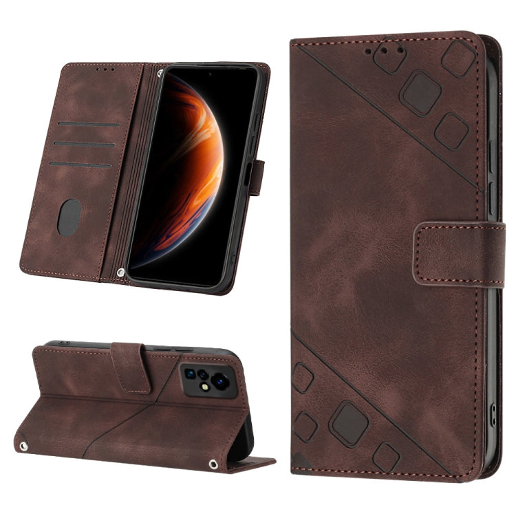 For Infinix Zero X / Zero X Pro X6811 Skin-feel Embossed Leather Phone Case