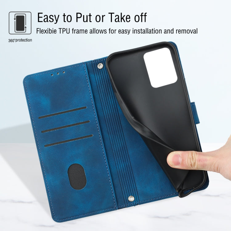 For Xiaomi Redmi Note 12 Global Skin-feel Embossed Leather Phone Case