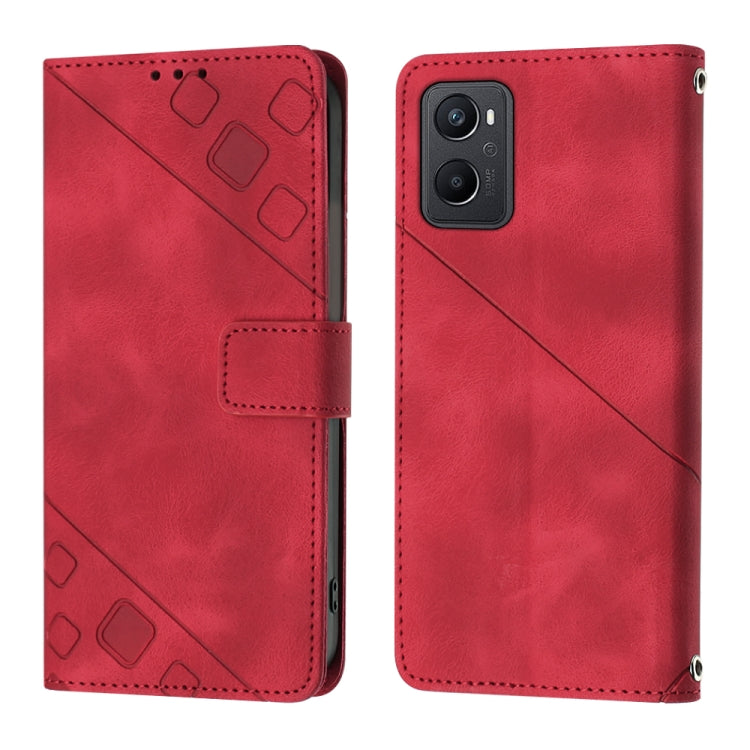 For OPPO A96 4G / A36 / A76 / Realme 9i Skin-feel Embossed Leather Phone Case
