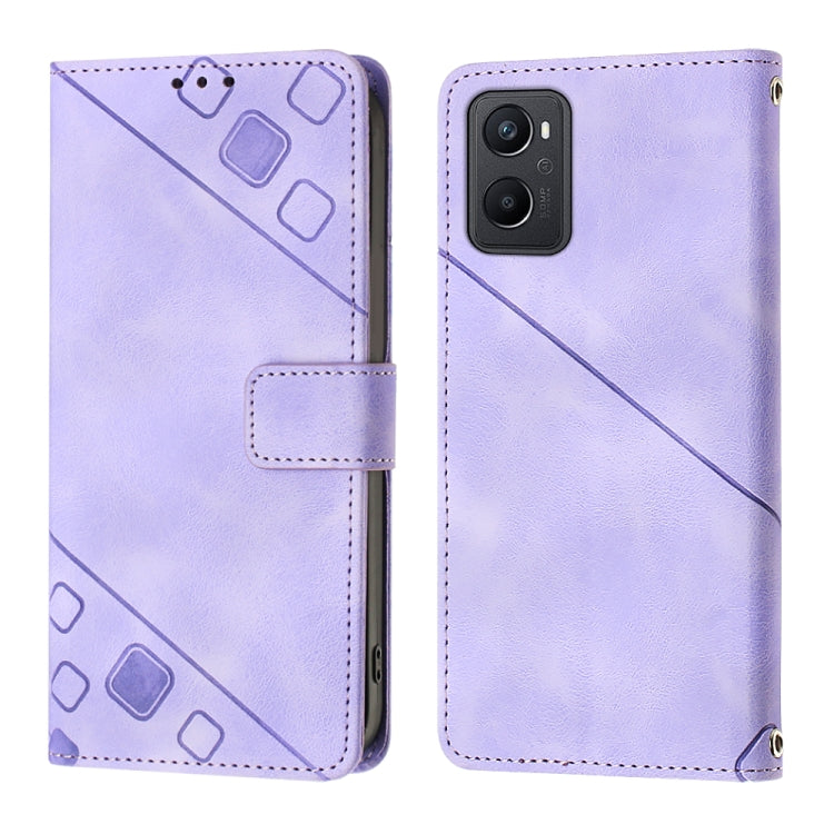 For OPPO A96 4G / A36 / A76 / Realme 9i Skin-feel Embossed Leather Phone Case