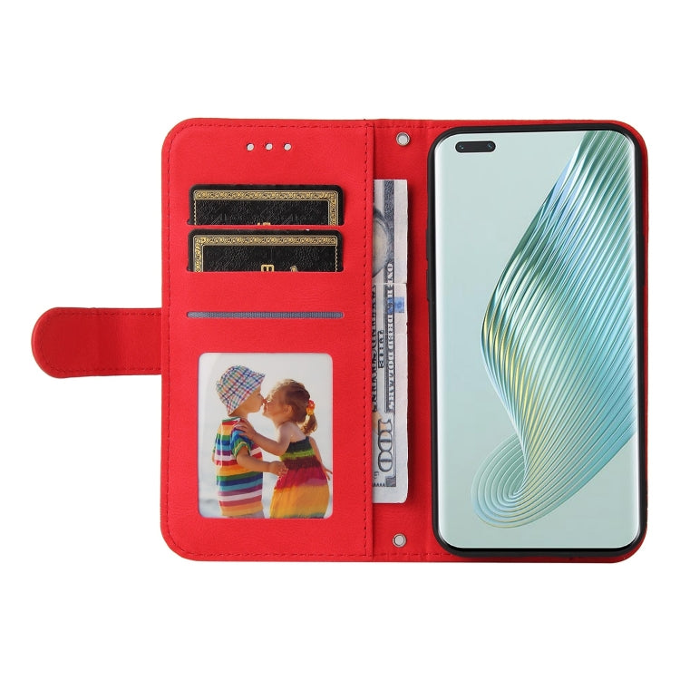 For Honor Magic5 Pro Skin Feel Life Tree Metal Button Leather Phone Case