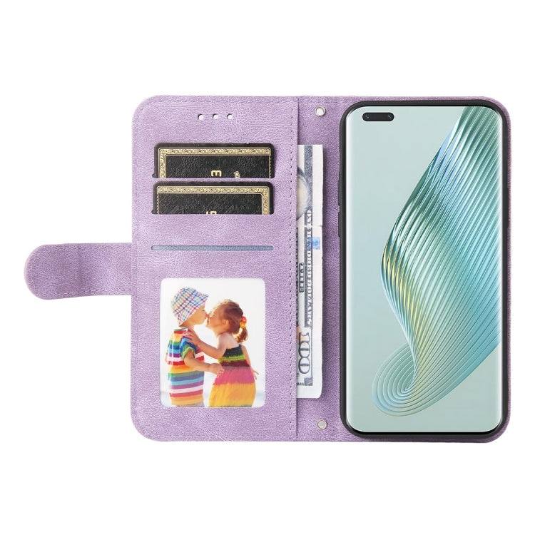 For Honor Magic5 Pro Skin Feel Life Tree Metal Button Leather Phone Case