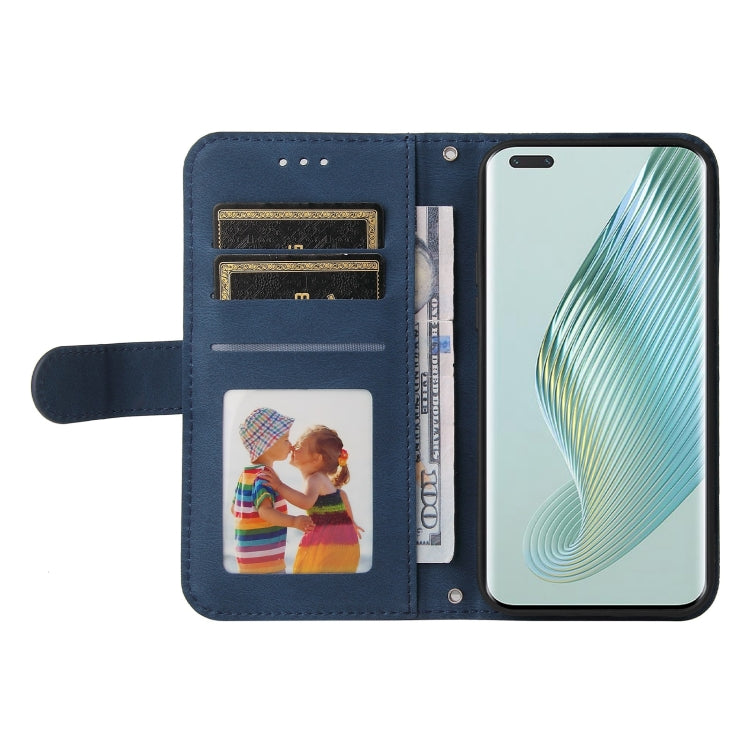 For Honor Magic5 Pro Skin Feel Life Tree Metal Button Leather Phone Case