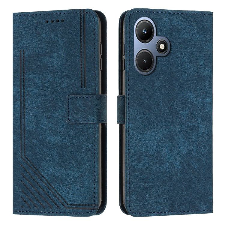 For Infinix Hot 30i Skin Feel Stripe Pattern Leather Phone Case with Lanyard