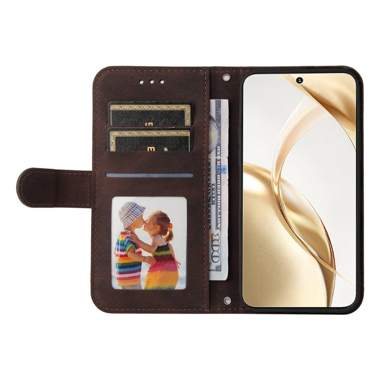 For Honor 200 Skin Feel Life Tree Metal Button Leather Phone Case