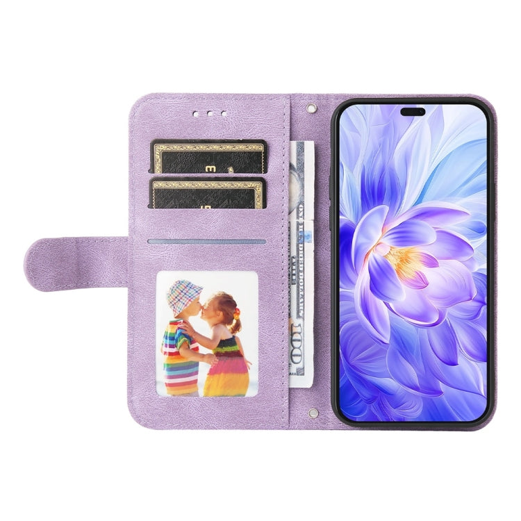 For Honor X60i Skin Feel Life Tree Metal Button Leather Phone Case
