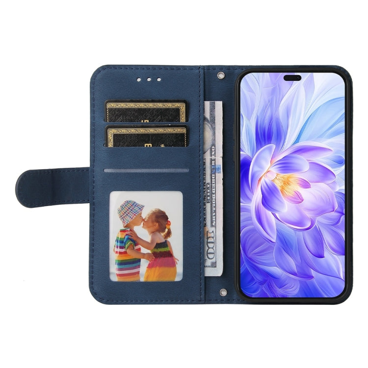 For Honor X60i Skin Feel Life Tree Metal Button Leather Phone Case