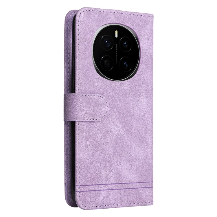 For Honor Magic7 Skin Feel Life Tree Metal Button Leather Phone Case