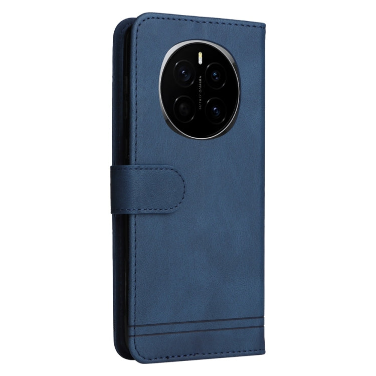 For Honor Magic7 Skin Feel Life Tree Metal Button Leather Phone Case