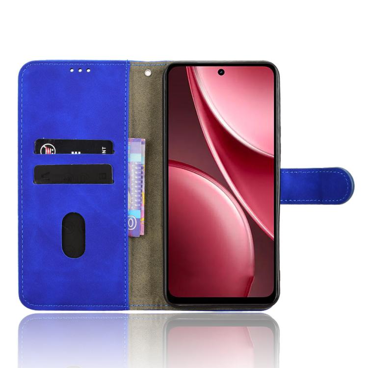 For vivo Y31 5G 2025 Skin Feel Magnetic Flip Leather Phone Case