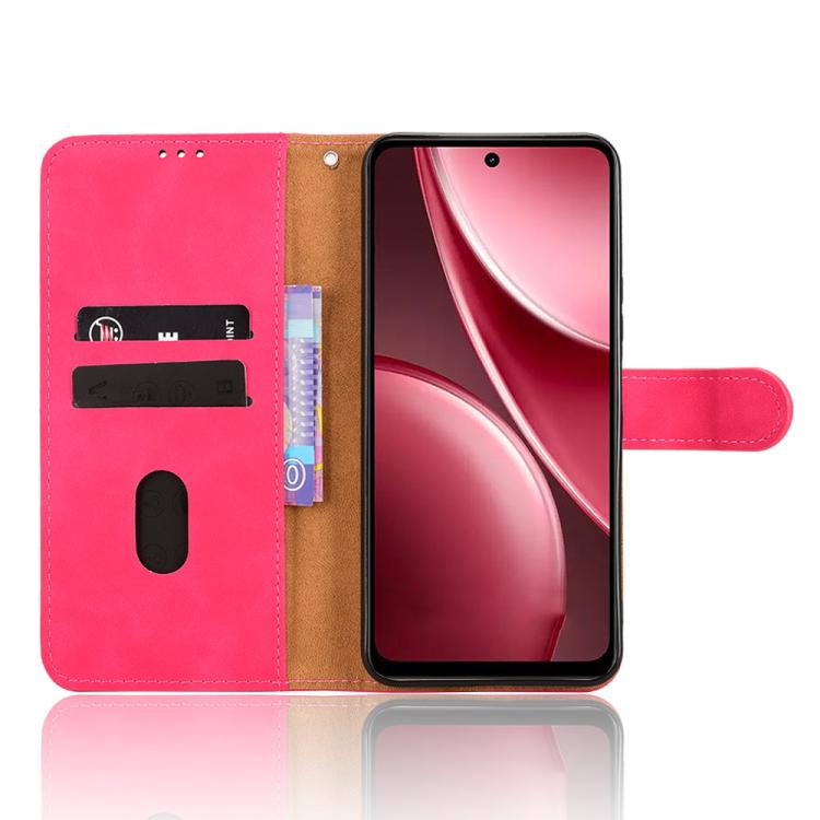 For vivo Y31 5G 2025 Skin Feel Magnetic Flip Leather Phone Case