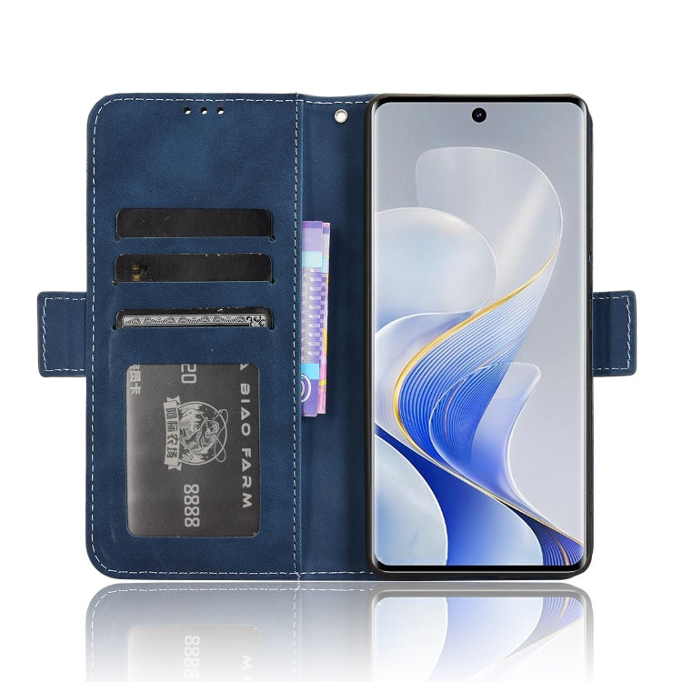 For vivo S19 Pro 5G / V40 5G Skin Feel Calf Texture Card Slots Leather Phone Case