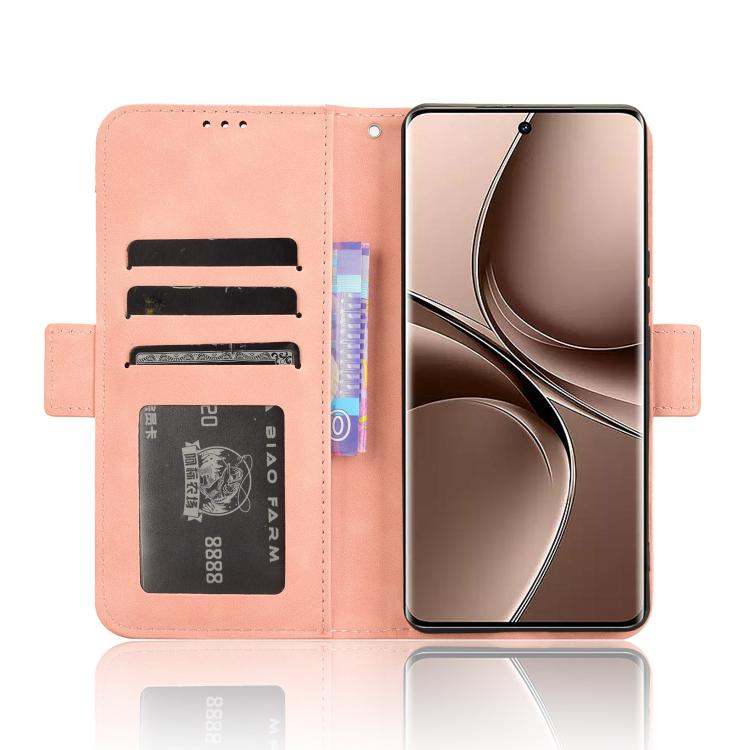 For vivo V40e 5G / iQOO Z9S 5G Skin Feel Calf Texture Card Slots Leather Phone Case