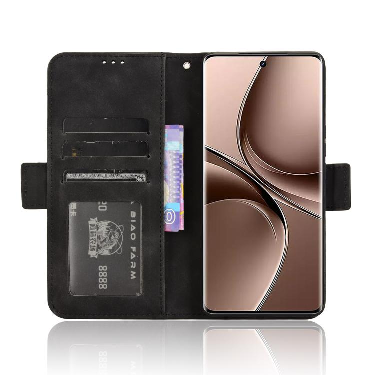 For vivo V40e 5G / iQOO Z9S 5G Skin Feel Calf Texture Card Slots Leather Phone Case