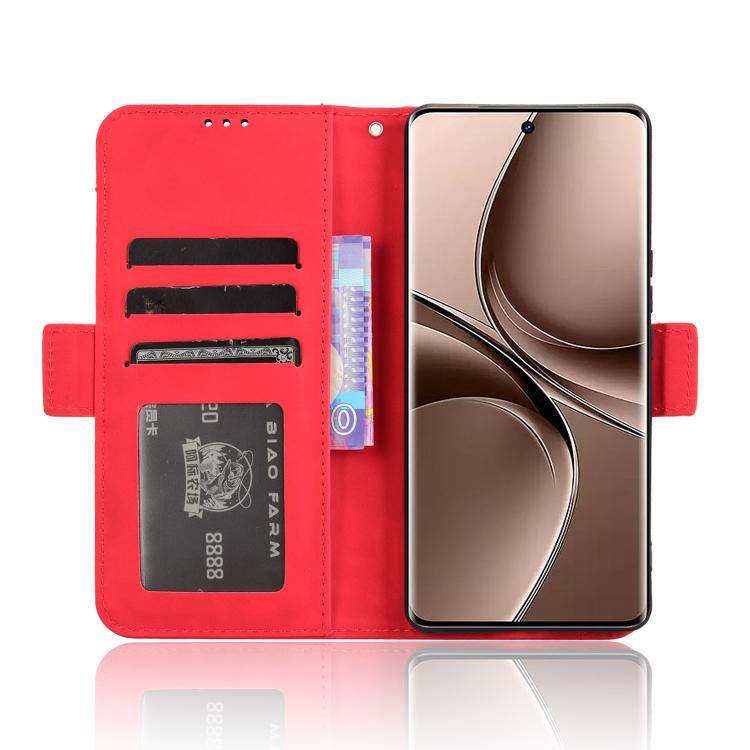 For vivo V40e 5G / iQOO Z9S 5G Skin Feel Calf Texture Card Slots Leather Phone Case