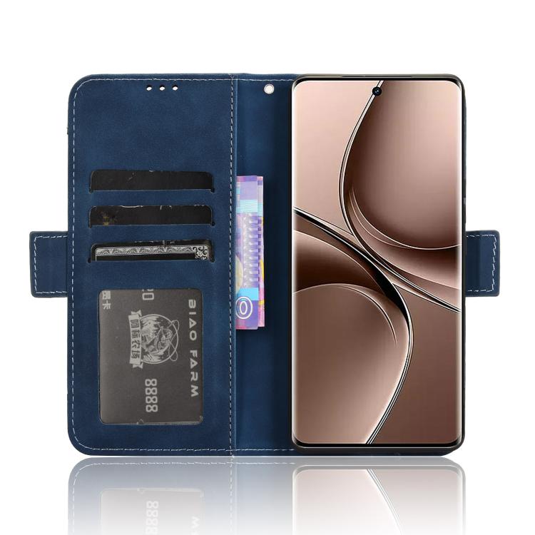 For vivo V40e 5G / iQOO Z9S 5G Skin Feel Calf Texture Card Slots Leather Phone Case