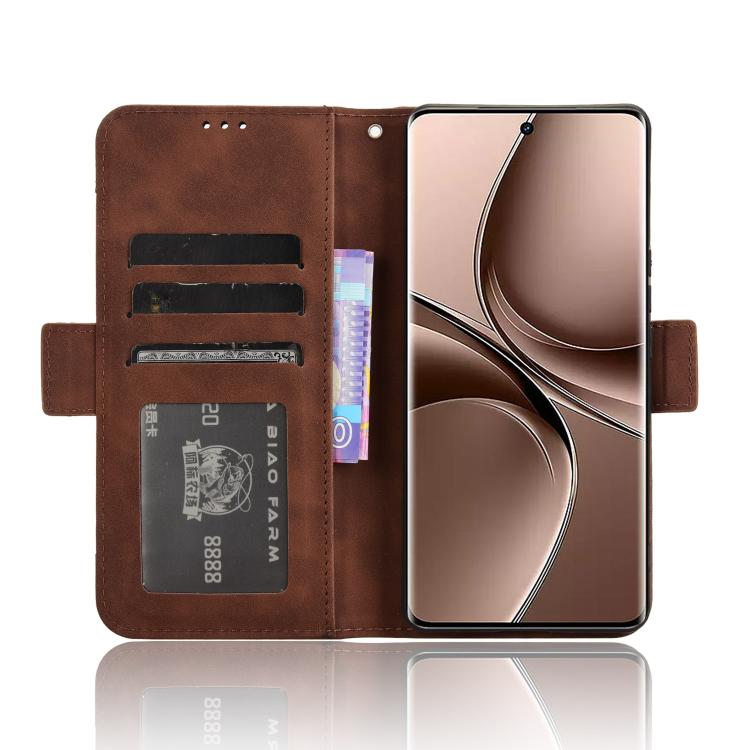 For vivo V40e 5G / iQOO Z9S 5G Skin Feel Calf Texture Card Slots Leather Phone Case