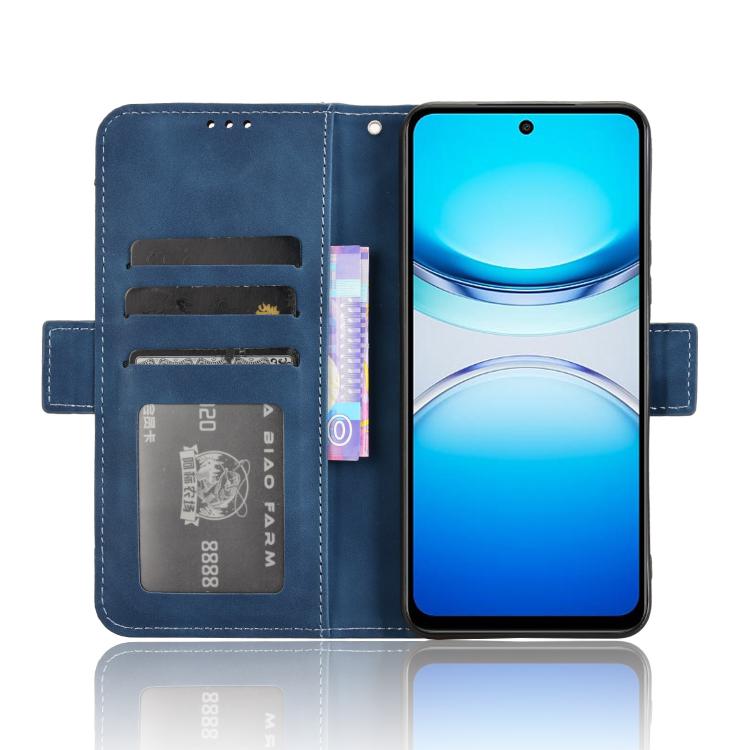 For vivo Y39 5G / Y300i Skin Feel Calf Texture Card Slots Leather Phone Case