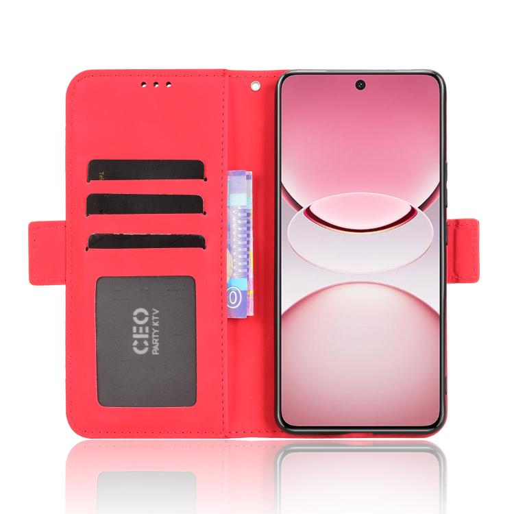 For vivo T4 5G / iQOO Z10 5G Global Skin Feel Calf Texture Card Slots Leather Phone Case