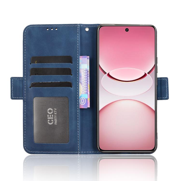 For vivo T4 5G / iQOO Z10 5G Global Skin Feel Calf Texture Card Slots Leather Phone Case