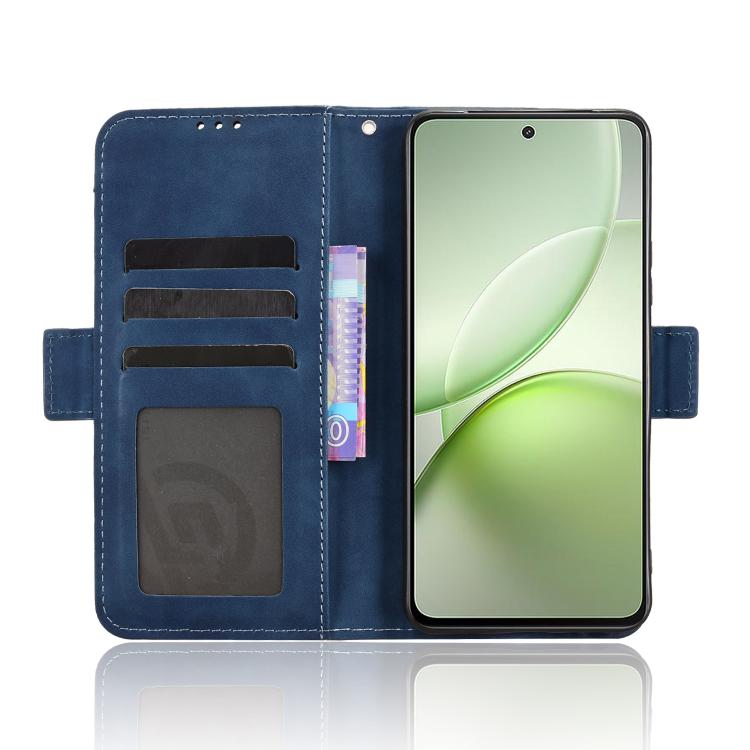 For vivo Y400 4G / 5G / iQOO Z10 Lite 4G Skin Feel Calf Texture Card Slots Leather Phone Case