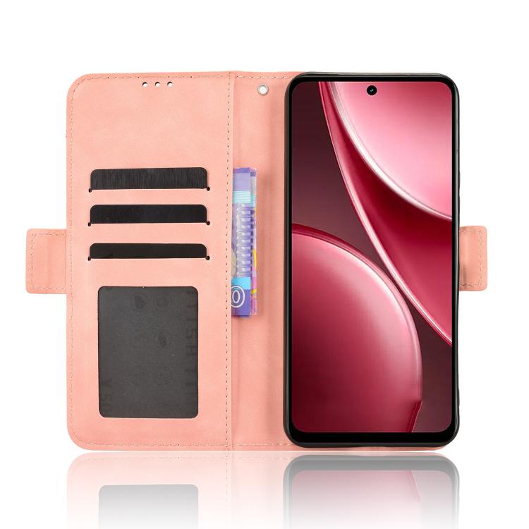 For vivo Y31 5G 2025 Skin Feel Calf Texture Card Slots Leather Phone Case