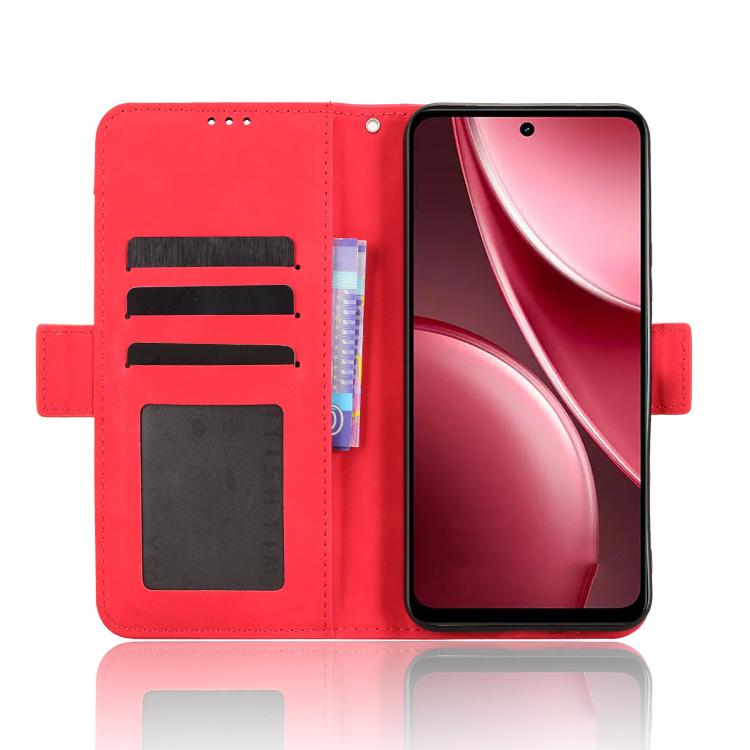 For vivo Y31 5G 2025 Skin Feel Calf Texture Card Slots Leather Phone Case
