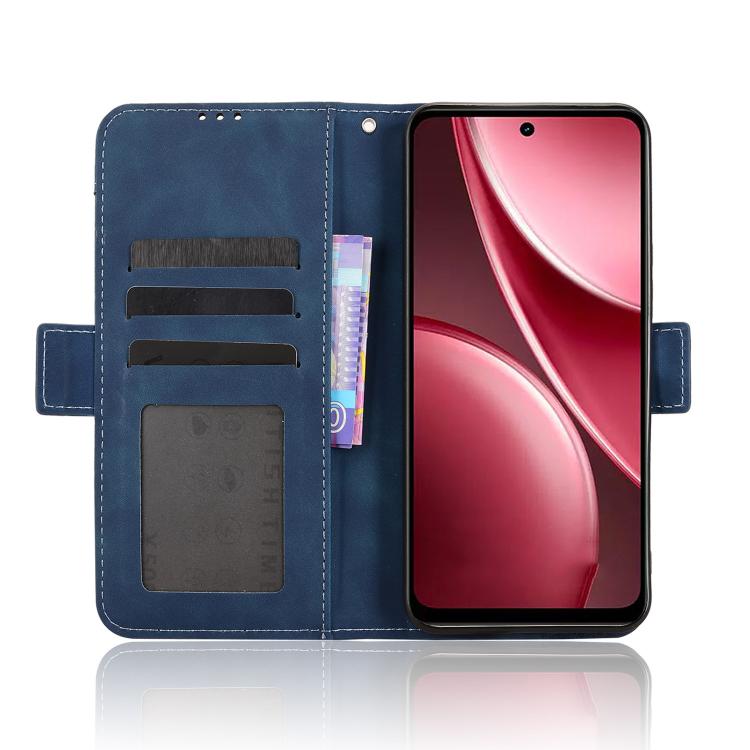 For vivo Y31 5G 2025 Skin Feel Calf Texture Card Slots Leather Phone Case