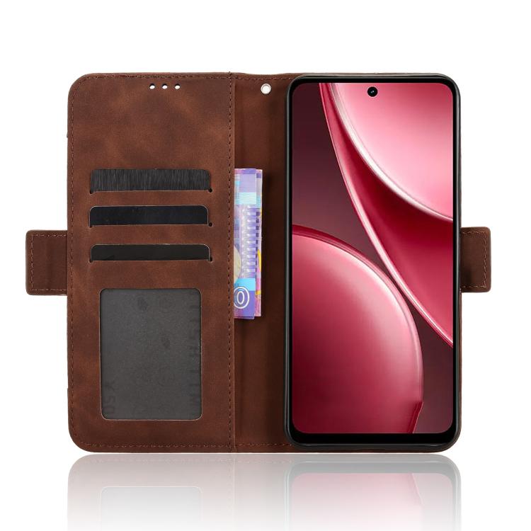 For vivo Y31 5G 2025 Skin Feel Calf Texture Card Slots Leather Phone Case