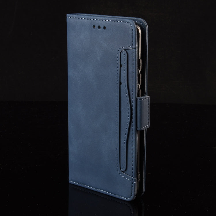 For Sony Xperia 10 VI 2024 Skin Feel Calf Texture Card Slots Leather Phone Case