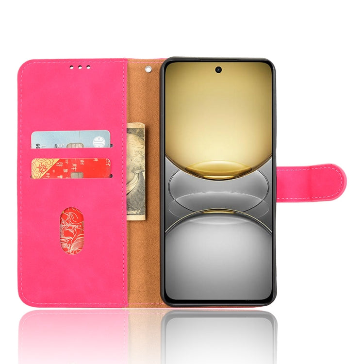 For Realme C75 4G Skin Feel Magnetic Flip Leather Phone Case