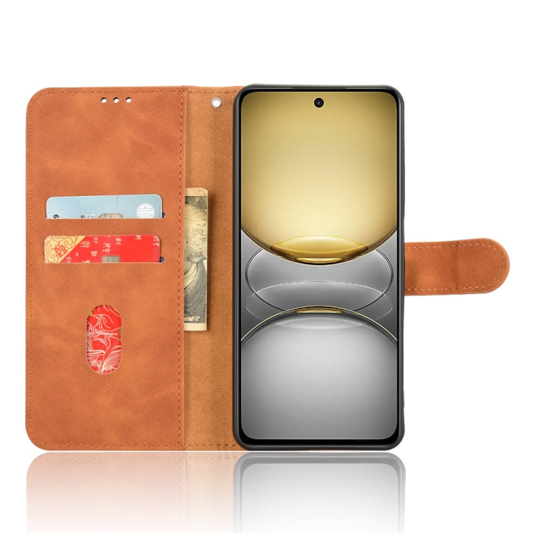 For Realme C75 4G Skin Feel Magnetic Flip Leather Phone Case