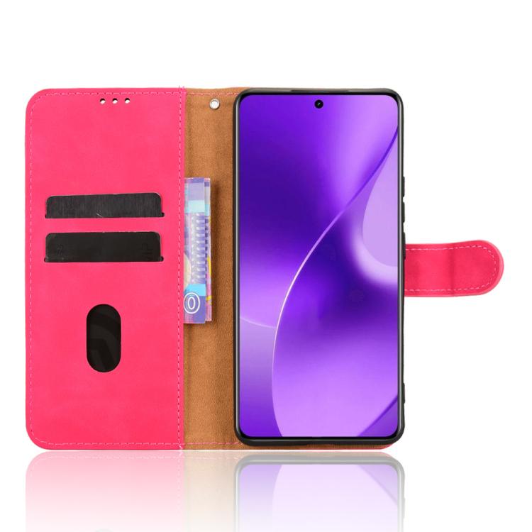 For Realme 15 5G Global Skin Feel Magnetic Flip Leather Phone Case