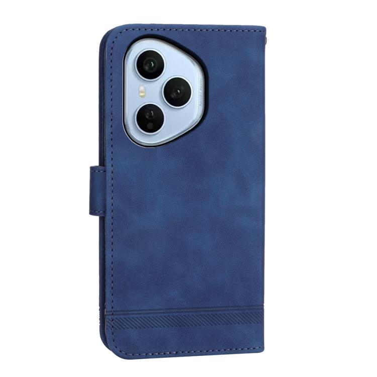 For OPPO Reno14 Global / Reno14 F 5G Dierfeng Dream Line TPU Hybrid PU Leather Phone Case