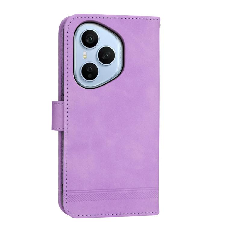 For OPPO Reno14 Global / Reno14 F 5G Dierfeng Dream Line TPU Hybrid PU Leather Phone Case