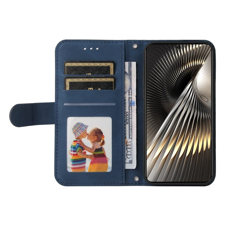 For Xiaomi Poco F6 Skin Feel Life Tree Metal Button Leather Phone Case