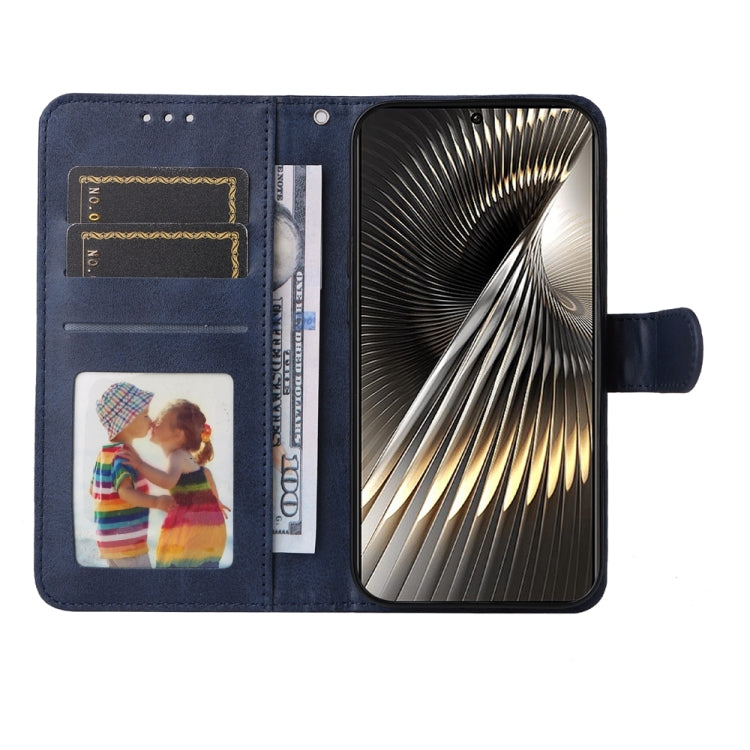 For Xiaomi Poco F6 Classic Calf Texture Flip Leather Phone Case